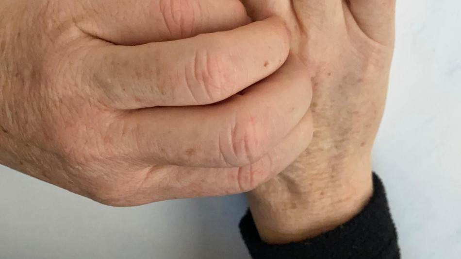 Scoperto perch&egrave; &egrave; irresistibile grattarsi