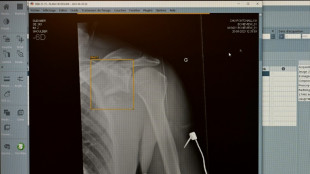 TÜV-Verband: Weniger Röntgengeräte mit Mängeln - Risiken bleiben aber