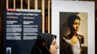 El retrato de un ni&ntilde;o palestino amputado gana el World Press Photo