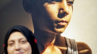 Le portrait d'un enfant palestinien amput&eacute; remporte le World Press Photo