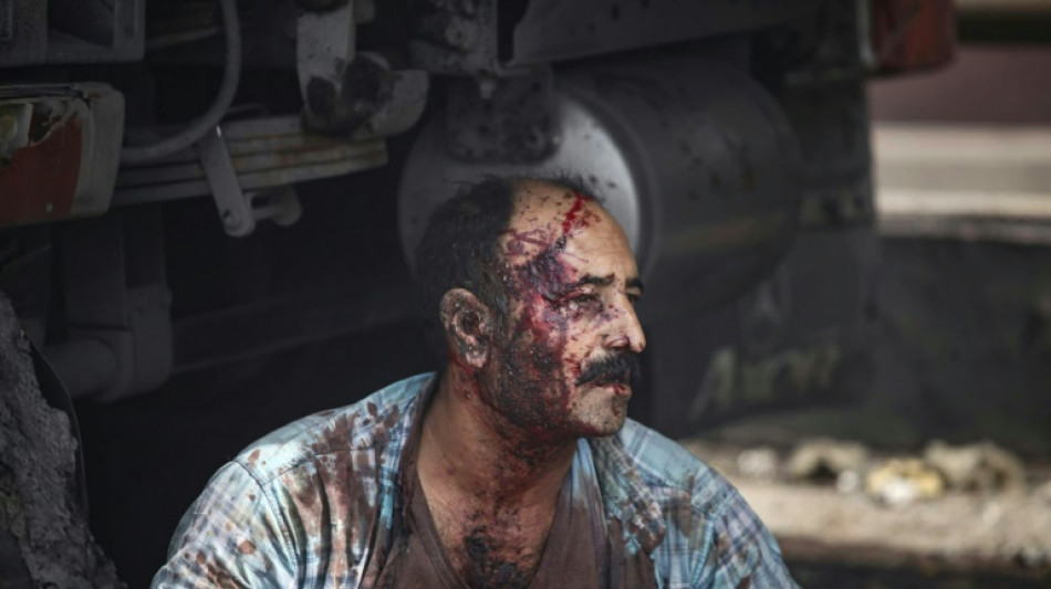 25 killed, fires still burning in huge Iran port blast