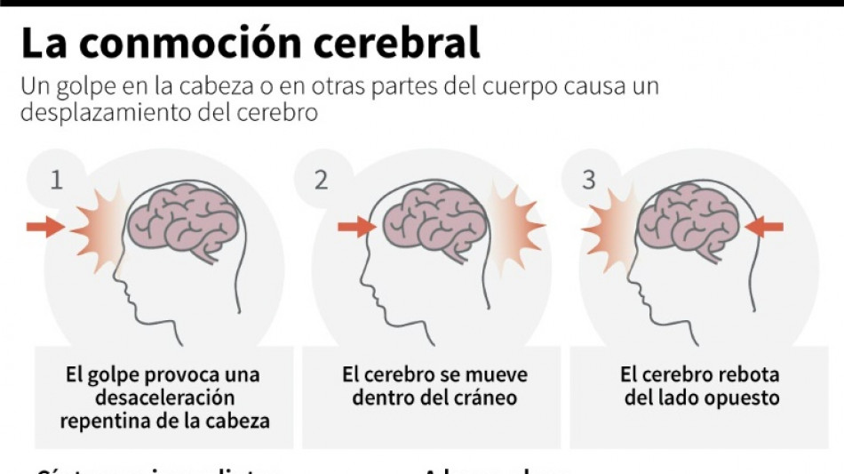 Argentina realiza estudio pionero en Am&eacute;rica Latina sobre lesiones cerebrales del rugby