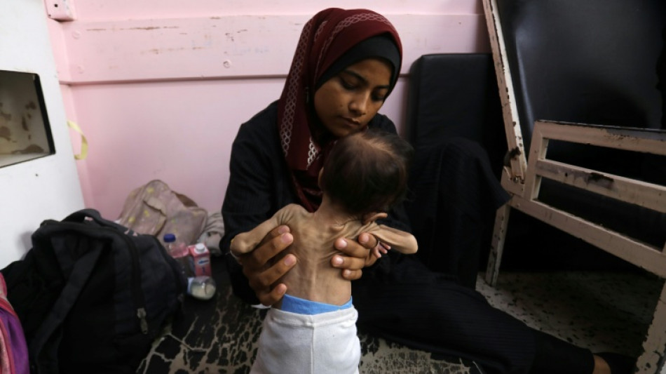 &Auml;rzte ohne Grenze wirft Israel Einsatz von "Hunger als Waffe" vor