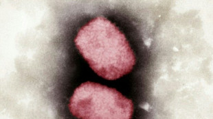 EU-Experten halten Risiko starker Ausbreitung der Affenpocken f&uuml;r "sehr gering"