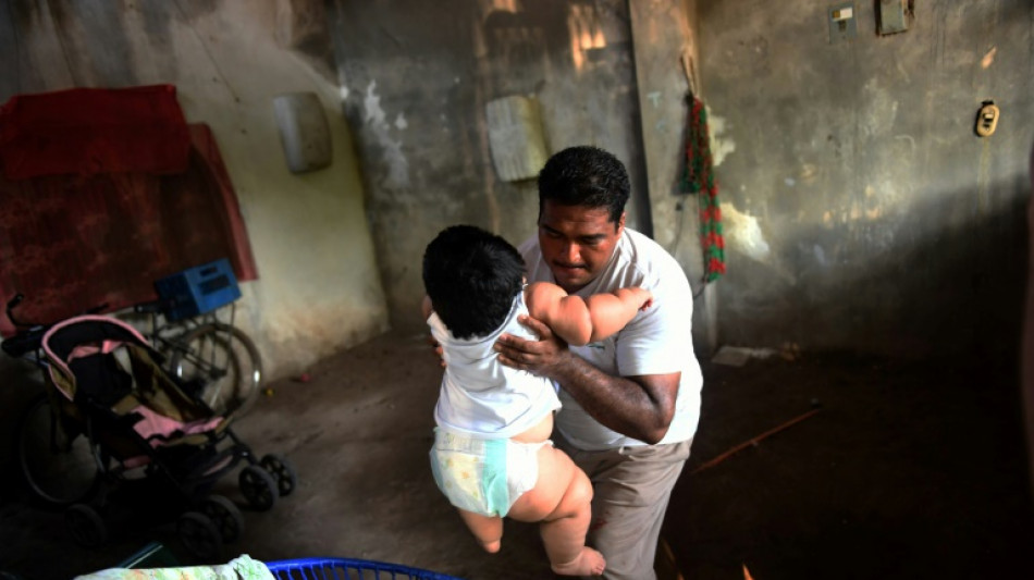 Los "costos ocultos" de los sistemas agroalimentarios superan el 10% del PIB mundial, seg&uacute;n la FAO