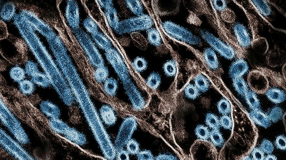 Grippe aviaire: r&eacute;apparition d'une souche transmissible &agrave; l'homme dans un &eacute;levage aux Etats-Unis