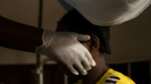 Variole du singe: une maladie rare dont on gu&eacute;rit en g&eacute;n&eacute;ral spontan&eacute;ment