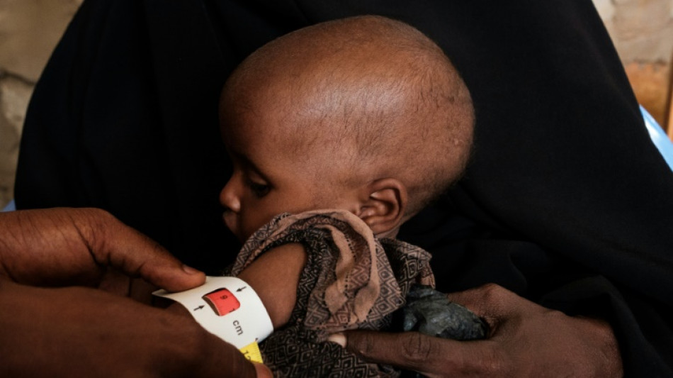 Mortalit&eacute; infantile toujours "alarmante" dans le monde, selon l'ONU