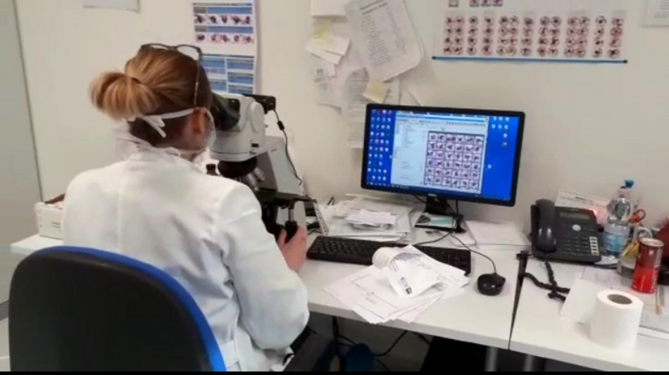 Allentato il freno delle cellule tumorali, impedisce attacco dalle cellule immunitarie