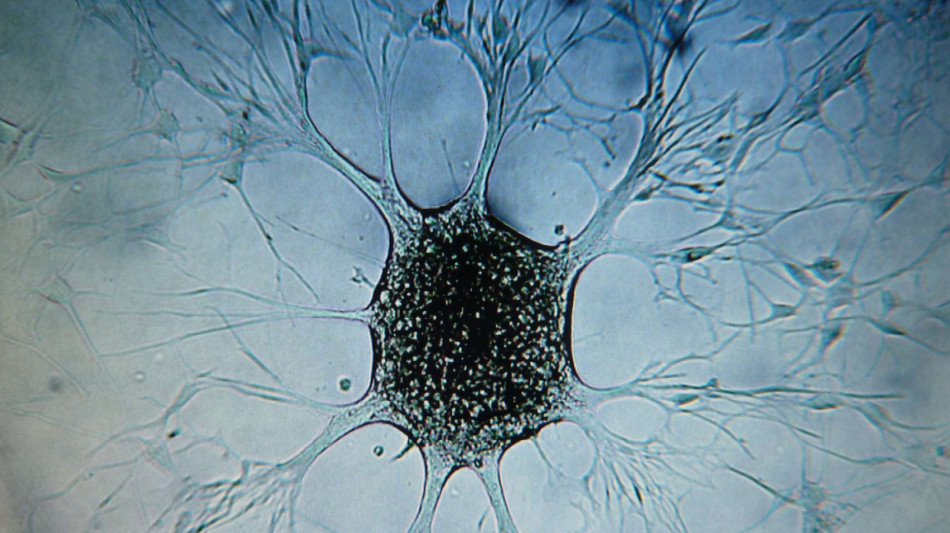 Spengono l'allarme, cos&igrave; i tumori sfuggono al sistema immunitario