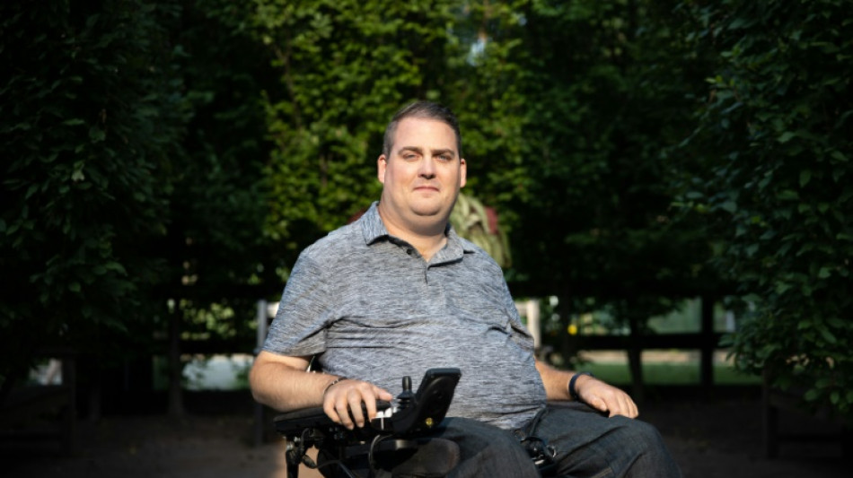 Magia ou rejei&ccedil;&atilde;o, duas experi&ecirc;ncias opostas com um implante cerebral