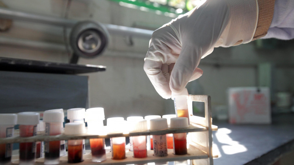 Scoperte cellule staminali nella retina, aprono a nuove terapie