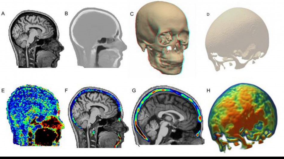 Dolore cronico da schiena a ginocchia, coinvolto il midollo osseo del cranio