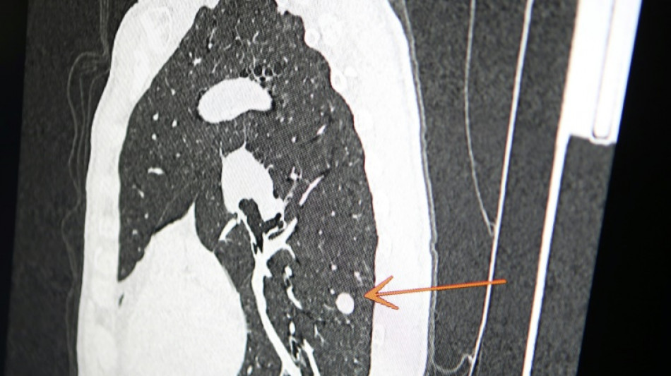 "Usted tiene c&aacute;ncer", mensaje err&oacute;neo y aterrador a cientos de pacientes de una cl&iacute;nica en Inglaterra