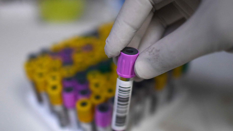 Da un'infusione di staminali beneficio duraturo in pazienti con rara malattia genetica