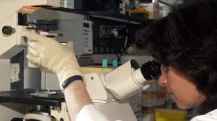 Ecco mappa proteine del sangue per diagnosi precoce di malattie