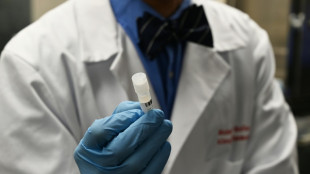 Don de moelle osseuse: controverse autour de la strat&eacute;gie fran&ccedil;aise